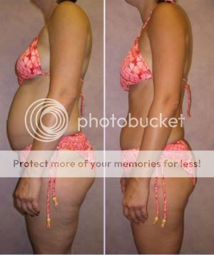 hcg diet phoenix scottsdale az